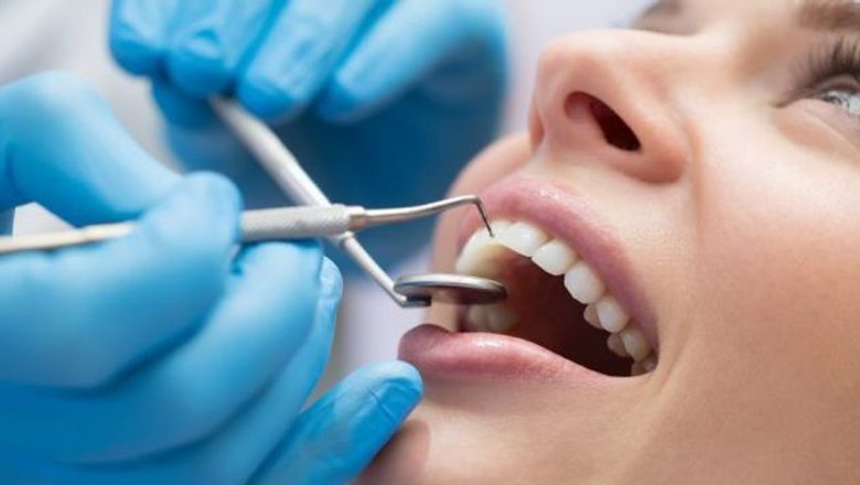 Frica de Dentist: Înțelegerea Profundă a Anxietății Dentare