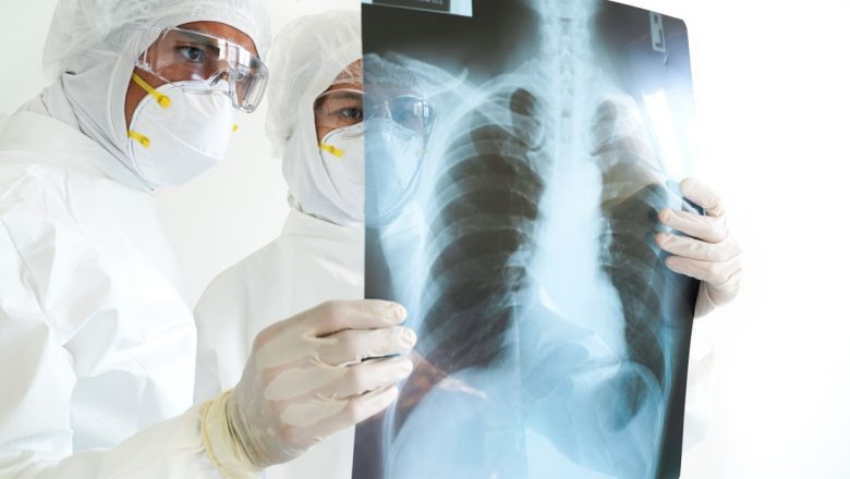 Investigațiile esențiale după recuperarea din COVID-19: Ce trebuie să știe cei afectați