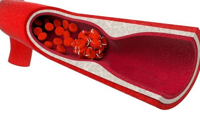 Anticoagulantele: Indicații, Riscuri și Impactul Asupra Sănătății Publice