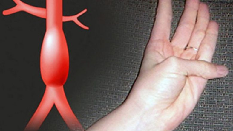 Testul degetului mare: O metodă simplă de depistare a riscurilor cardiovasculare