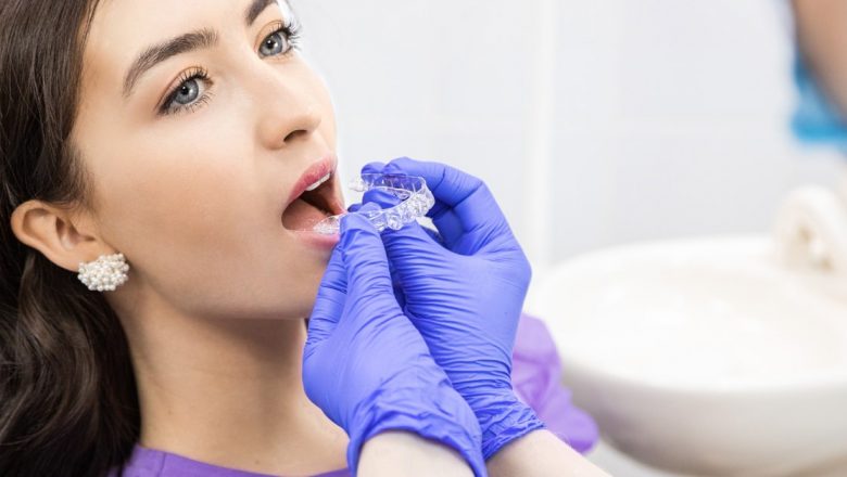 Avantajele Tratamentului Ortodontic: Importanța Poziționării Corecte a Dinților pentru Sănătatea Generală