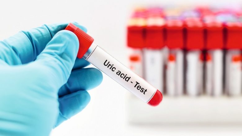Învățând să Înțelegem Acidul Uric: Semnificația, Riscurile și Implicațiile pentru Sănătate