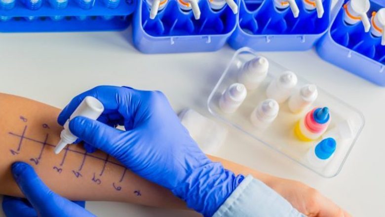 Diagnosticarea alergiilor: Testele esențiale pentru sănătatea ta