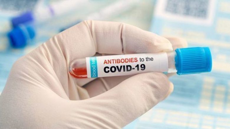 Tot ce trebuie să știi despre testele COVID-19: importanța tomografiei și a altor analize
