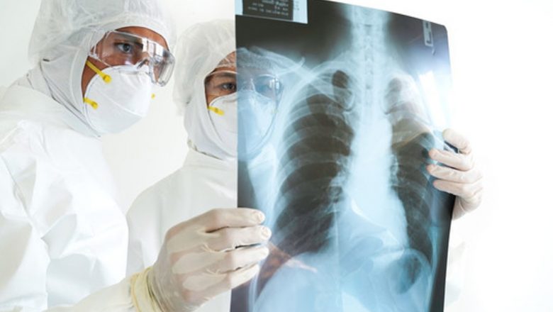 Impactul fumatului asupra sănătății: De la o țigară la cancerul pulmonar