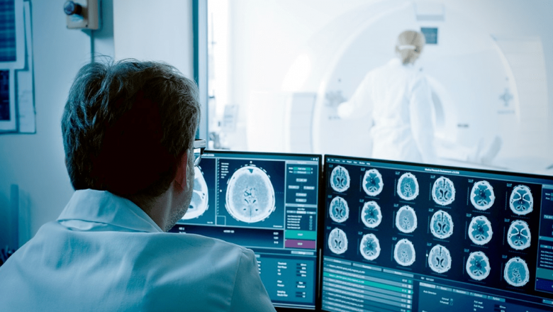 Cum să recunoști semnele unui accident vascular cerebral: Importanța intervenției rapide și înțelegerea simptomelor
