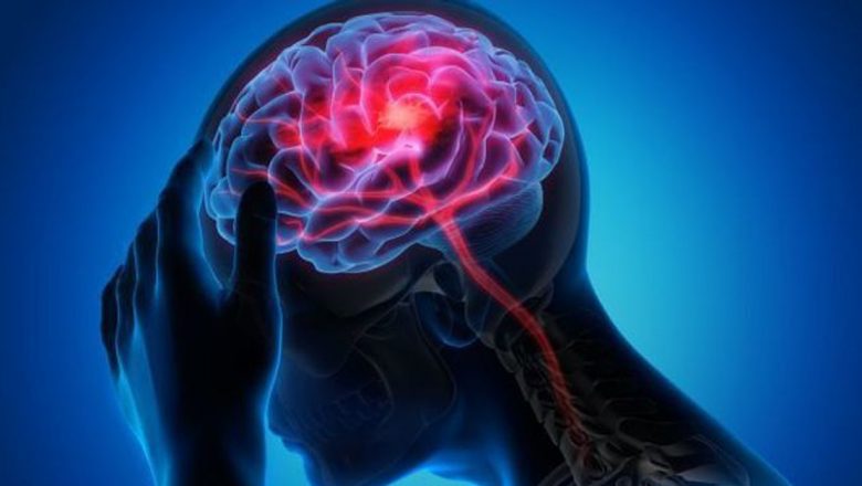 Cum să Prevenim Accidentul Vascular Cerebral: Zece Reguli Esențiale pentru Sănătatea Ta