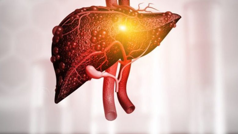 Alimentația în Ficatul Gras: Ghid Complet pentru Dieta Recomandată în Steatoza Hepatică