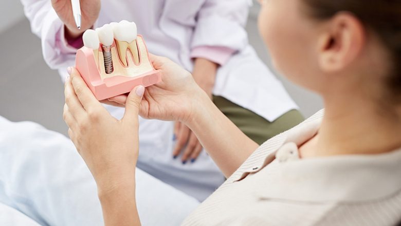 Implantul Dentar: O Soluție Modernă și Eficientă pentru Sănătatea Orală