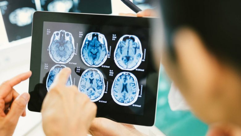 Cum să recunoaștem și să reacționăm la un accident vascular cerebral: ghid complet
