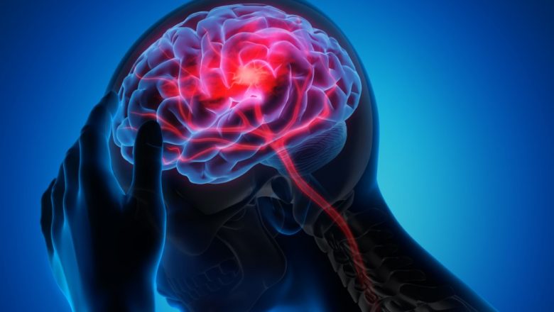 Complexitatea recuperării neurologice post-AVC: Provocări și soluții în era modernă