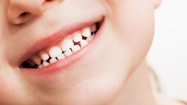 Importanța prevenirii cariilor dentare în copilărie: Ghidul părinților pentru o dantură sănătoasă