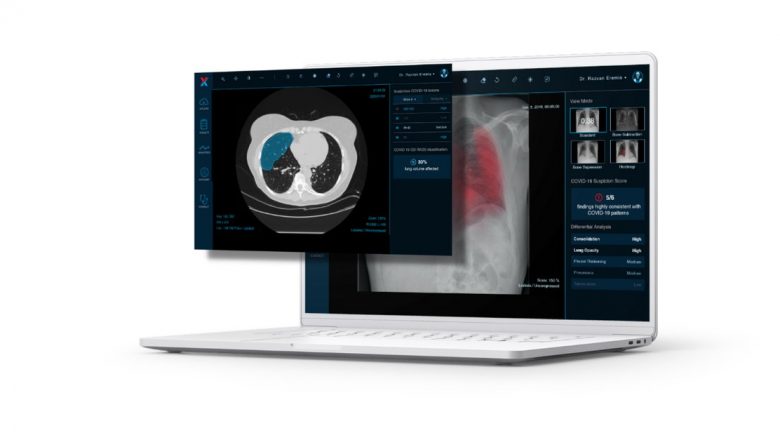 Reţeaua Regina Maria Inovează în Diagnosticul Medical prin Inteligenţa Artificială: Impactul Tehnologiei XVision în Imagistica Toracică