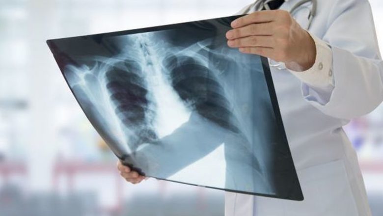 Cum să-ți menții plămânii sănătoși: Ghid complet pentru prevenirea bolilor respiratorii