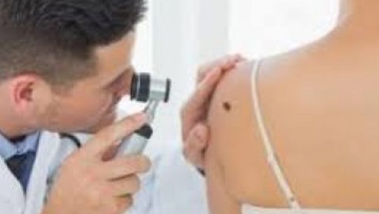 Importanța Monitorizării Alunițelor: Interviu cu Dr. Anca Zbranca, Dermatolog