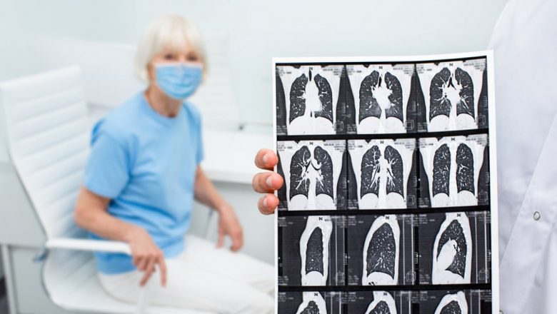 Importanța Tomografiei Computerizate în Diagnosticarea COVID-19 și Alte Afecțiuni