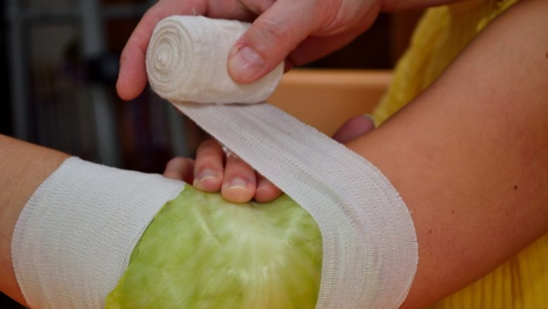 Compresele cu Varză: Tradiție și Eficiență în Medicina Populară