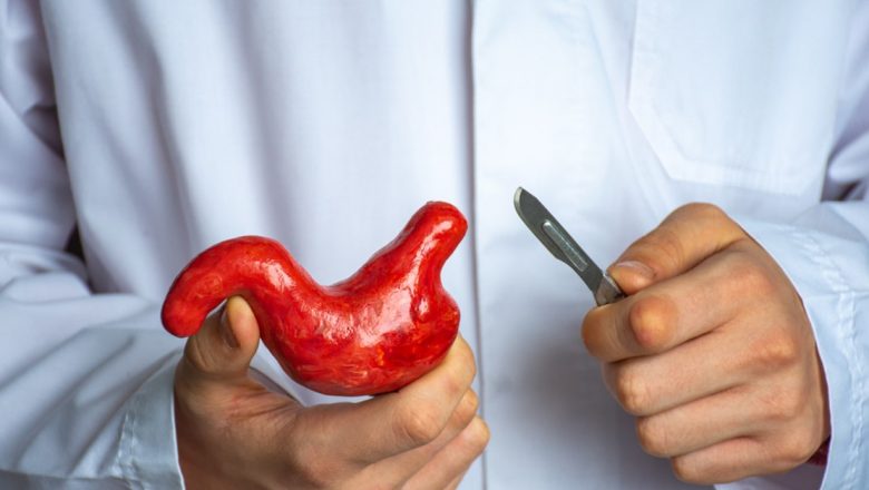 Chirurgia Bariatrică: O Soluție Eficientă Pentru Obezitate și Îmbunătățirea Sănătății