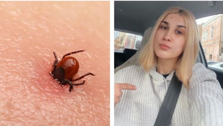 Borelioza: O privire detaliată asupra bolii care a afectat-o pe Adda și impactul acesteia asupra sănătății publice