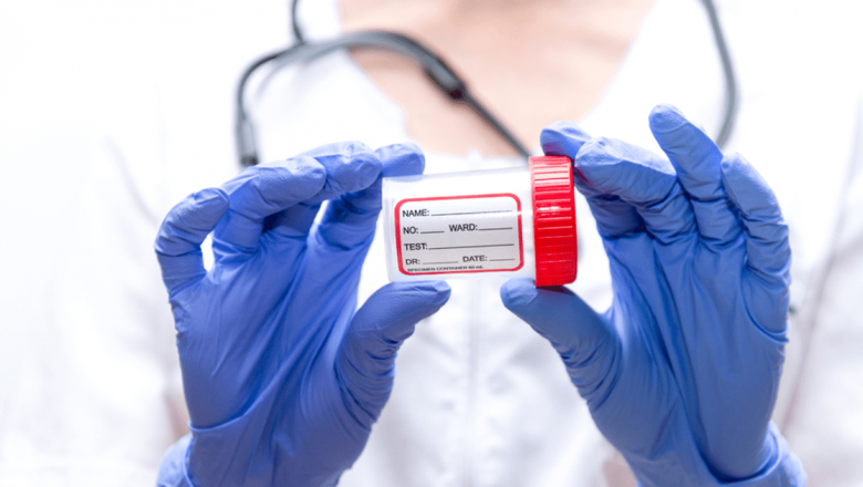 Examenul coproparazitologic: O privire detaliată asupra analizei materiilor fecale și a importanței sale în diagnosticarea parazitozelor intestinale