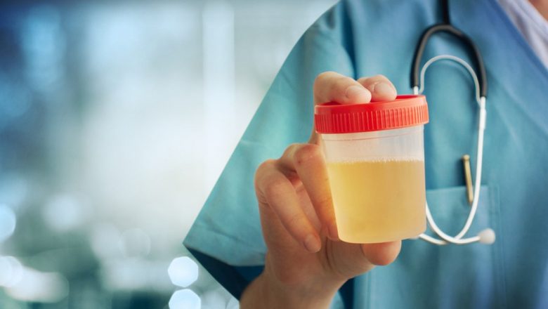 Indicatoare de Sănătate: Ce Ne Spune Culoarea și Mirosul Urinei despre Starea Noastră