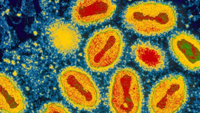 Variola maimuței: O nouă amenințare globală pe fondul infecțiilor cu transmitere sexuală