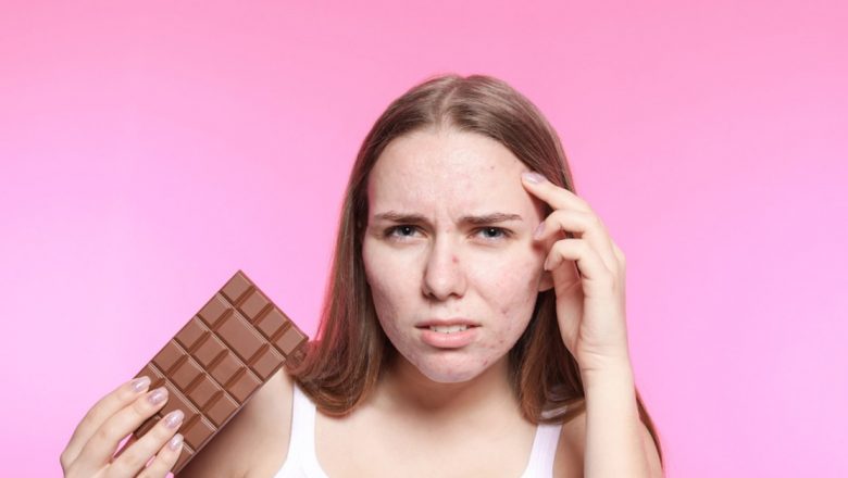 Legătura dintre consumul de dulciuri și apariția acneei: O analiză detaliată