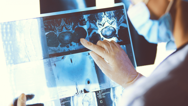 Înțelegerea Cancerului: Mecanismele Formării și Rolul Crucial al Prevenției