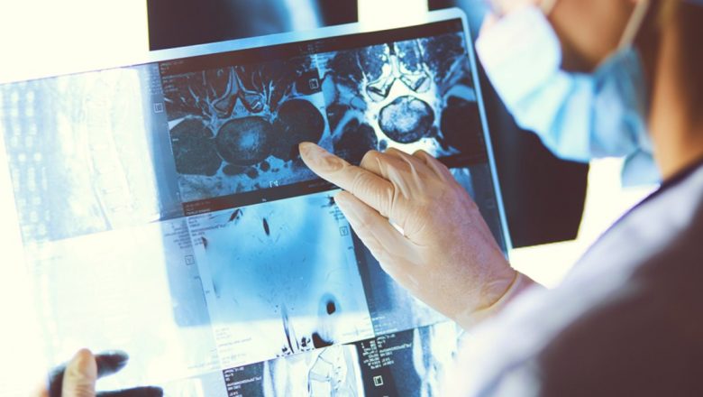 Cancerul: Mecanismele formării, rolul prevenției și impactul asupra societății