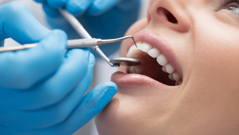 Igienizarea Dentară: Cât de Frecvent Ar Trebui Să Ne Îngrijim Dantura?