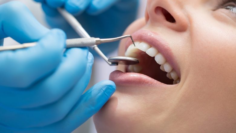 Importanța igienizării dentare: Cât de des ar trebui să ne îngrijim dantura?