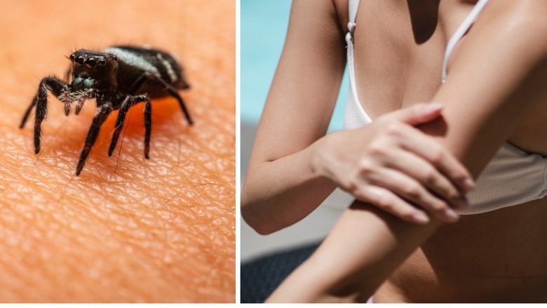 Leacuri și remedii bătrânești pentru înțepăturile de insecte: O abordare naturistă pentru vară