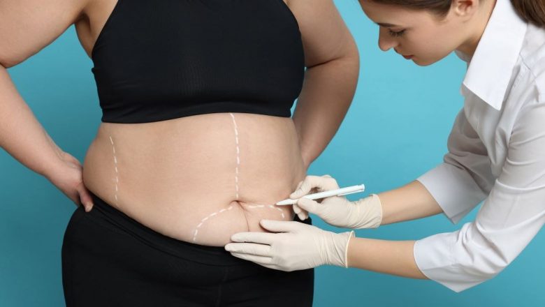 Chirurgia Bariatrică: O Soluție Promițătoare pentru Diabet și Obezitate