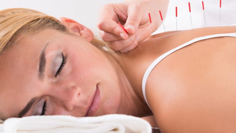 Beneficiile Acupuncturii: O Privire Detaliată Asupra Eficienței și Impactului Său