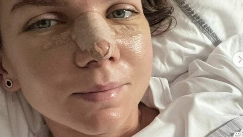 Simona Halep: Între Lupta cu Anxietatea și Recuperarea după Intervenții Chirurgicale