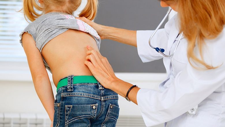 Cum să identifici și să tratezi scolioza la copii: Ghid complet pentru părinți