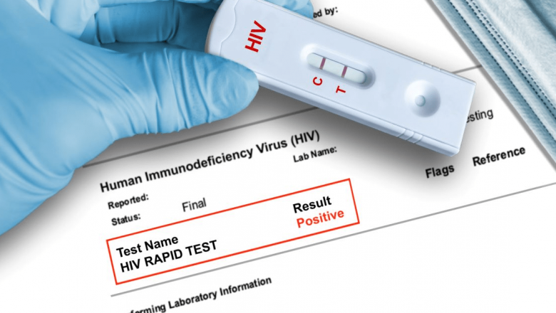 Importanța testării gratuite și anonime pentru HIV și hepatita C: O oportunitate crucială în lupta împotriva epidemiei