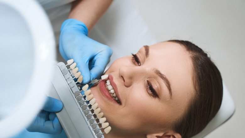 Stomatologia cosmetică: Soluții pentru problemele de sănătate orală și impactul acestora asupra încrederii în sine