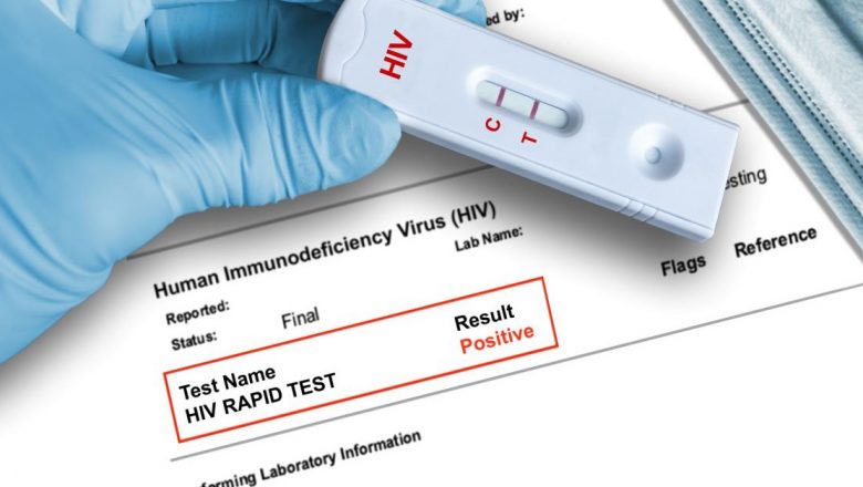 Testarea Gratuită și Anonimă pentru HIV și Hepatita C: O Inițiativă Esențială în Lupta Împotriva Epidemiei