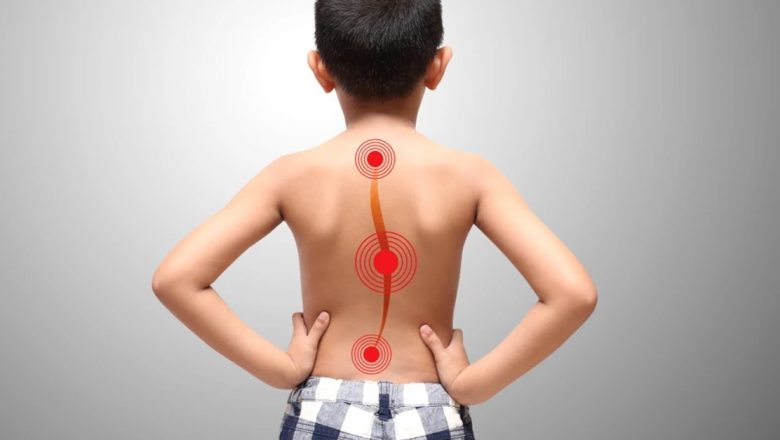 Scolioza la copii: Semne de avertizare, testare acasă și soluții de tratament