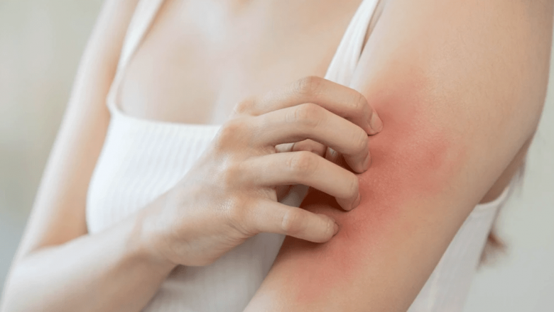 Afecțiunile dermatologice frecvente în România: O privire detaliată asupra sănătății pielii