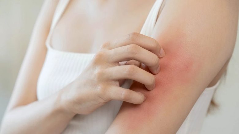 Afecțiunile dermatologice frecvente în România: un apel la prevenție și conștientizare