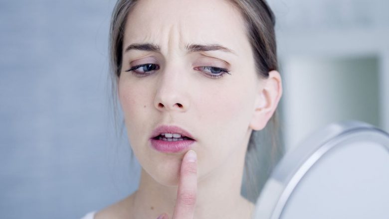 Ghid complet pentru gestionarea herpesului: Soluții și remedii eficiente
