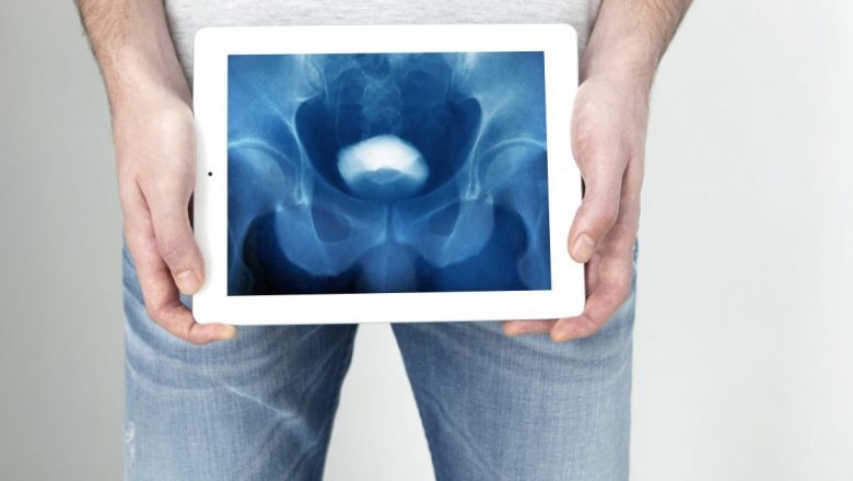 Urografia intravenoasă: O privire detaliată asupra diagnosticului bolilor renale și a căilor urinare