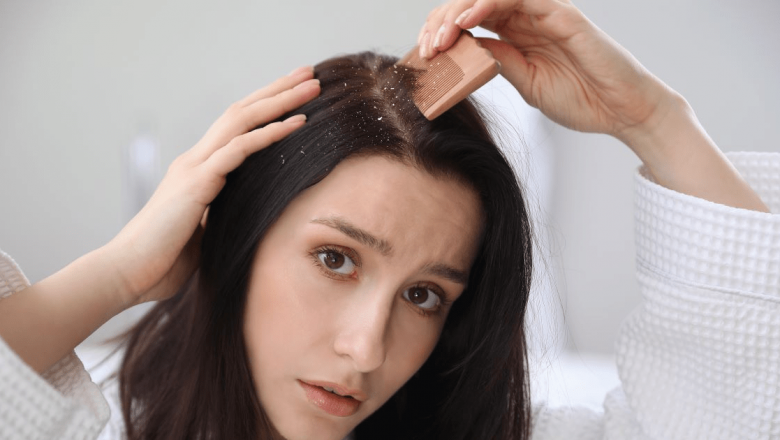 Dermatita seboreică: Cauze, simptome și tratamente – O privire detaliată asupra unei afecțiuni frecvente