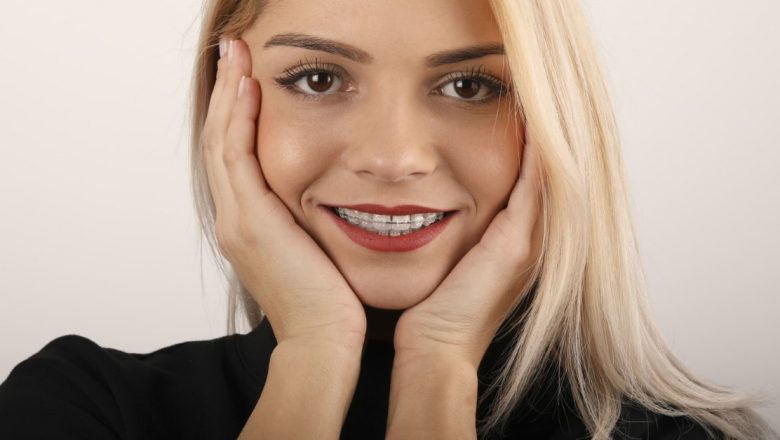 Îndreptarea dinților: Opțiuni, avantaje și implicatii pe termen lung pentru un zâmbet sănătos
