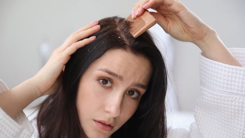 Dermatita Seboreică: Cauze, Simptome și Tratament – O Analiză Detaliată