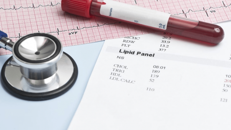 Analizele de sânge esențiale pentru evaluarea riscului de infarct: O privire detaliată