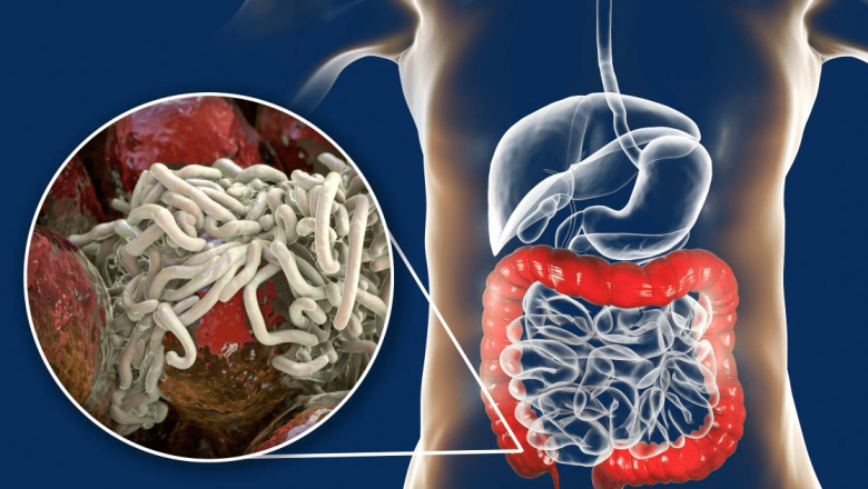 Paraziții intestinali: Semne, remedii naturale și impactul asupra sănătății
