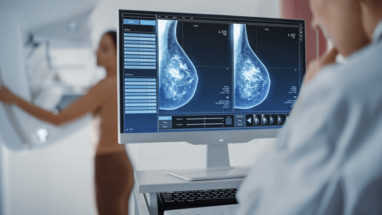 Semnele Cancerului de Sân: Cunoașterea Este Putere în Lupta Împotriva Bolii